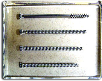 Photo of the Screws