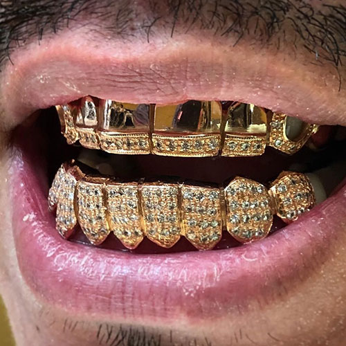 Fancy teeth grill